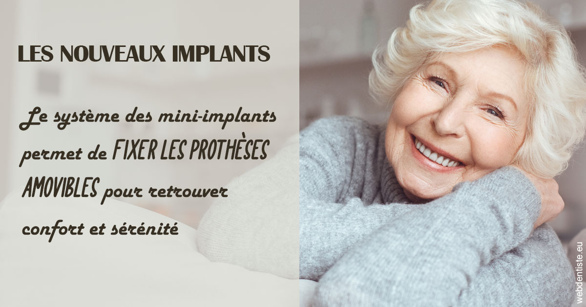 https://www.docteur-nooshika.fr/Les nouveaux implants 1