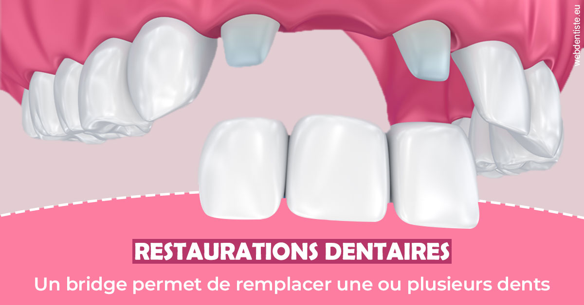 https://www.docteur-nooshika.fr/Bridge remplacer dents 2