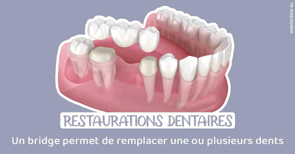 https://www.docteur-nooshika.fr/Bridge remplacer dents 1