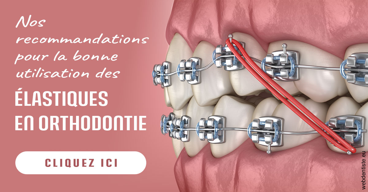 https://www.docteur-nooshika.fr/Elastiques orthodontie 2